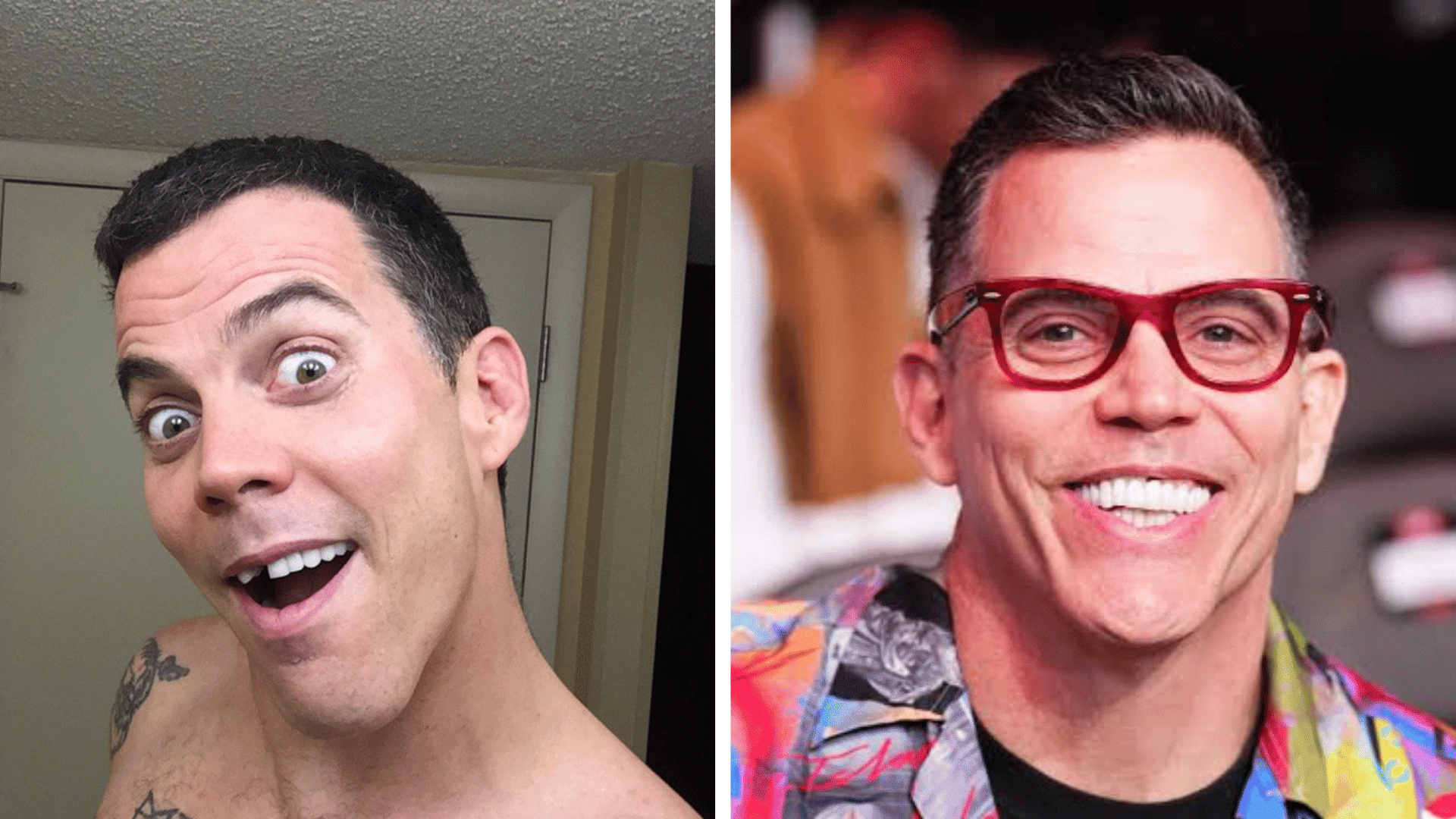 Steve O before and after dental appearance comparison showing changes in his smile and teeth.