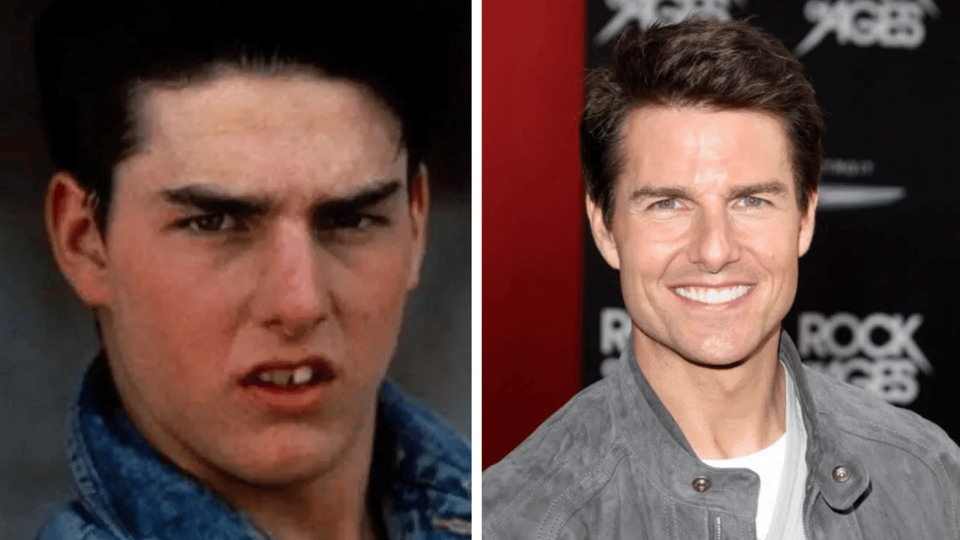 Tom Cruise before and after dental appearance comparison showing changes in his smile and teeth.
