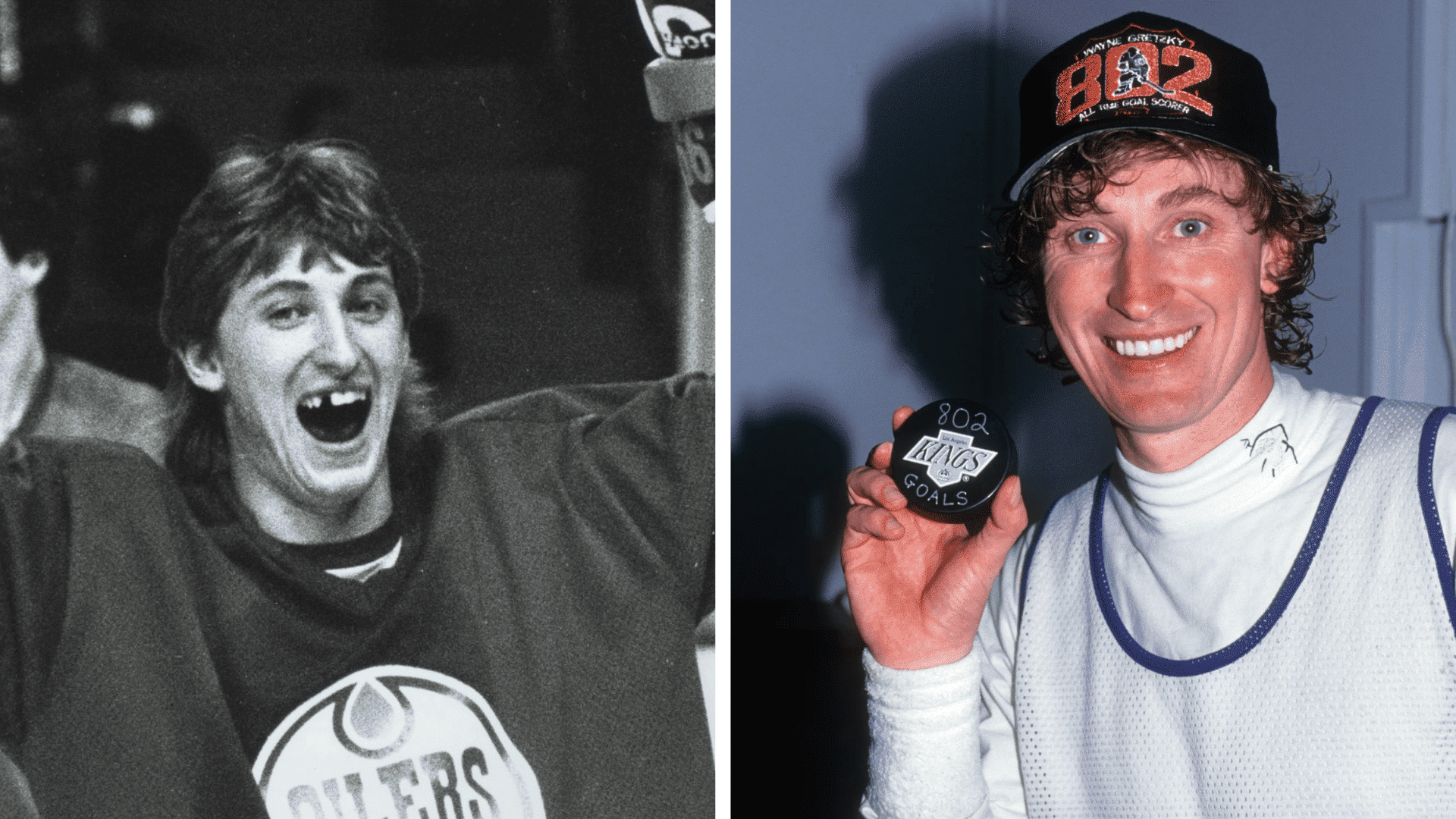 Wayne Gretzky before and after dental appearance comparison showing changes in his smile and teeth.